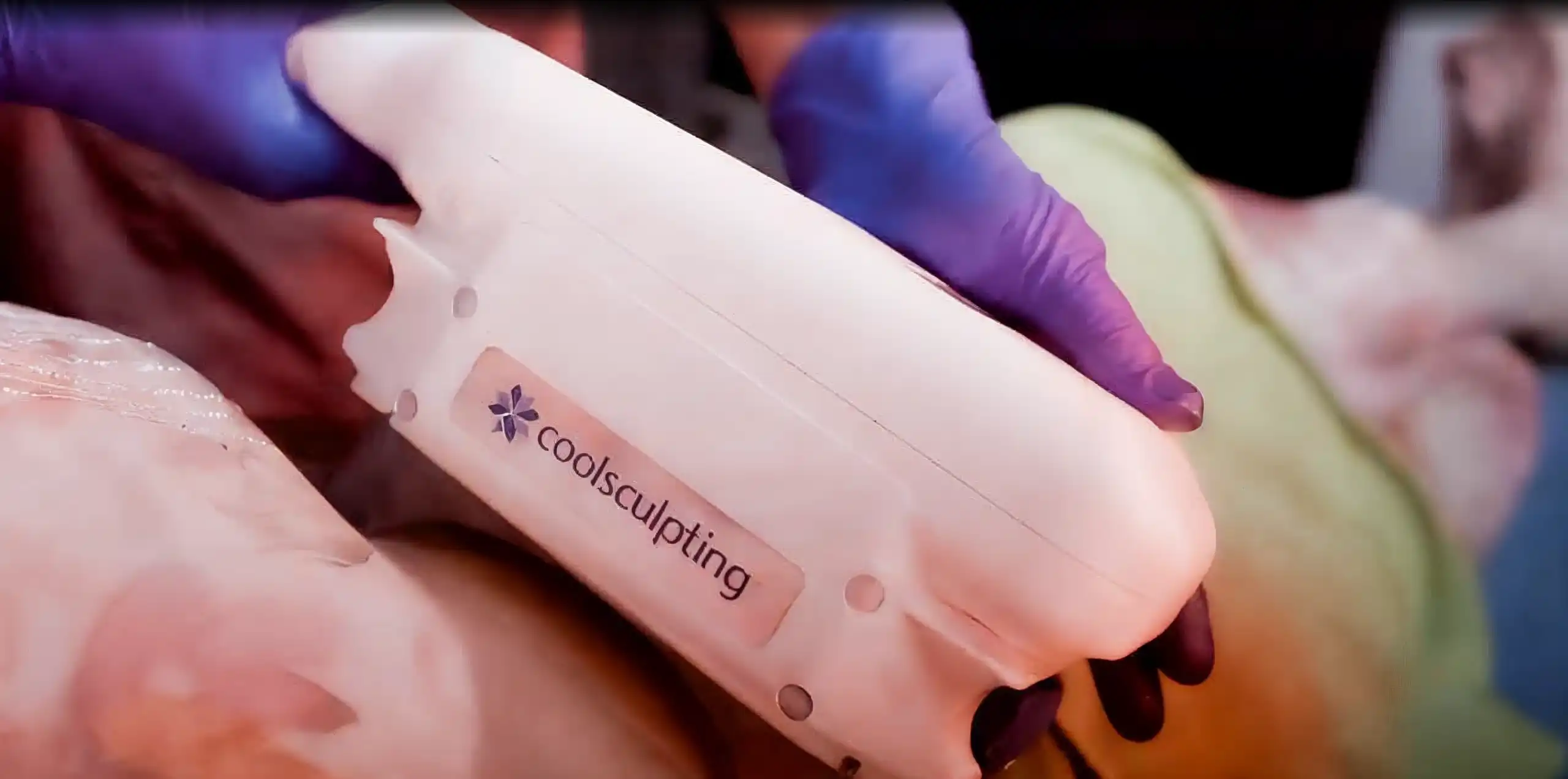 coolsculpting treatment